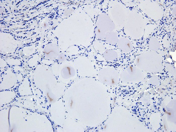 SNAIL antibody