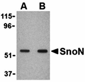 SnoN Antibody