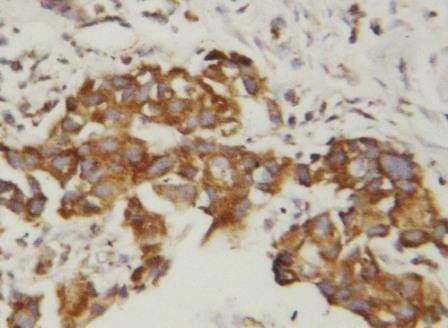 Superoxide Dismutase 1/SOD1 Antibody