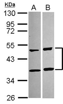 SQSTM1 antibody