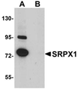 SRPX1 Antibody