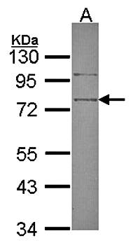 SRPX antibody