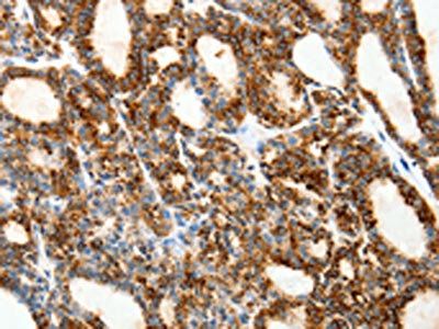 SSTR1 Antibody