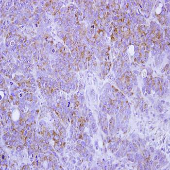 ST3GAL2 antibody
