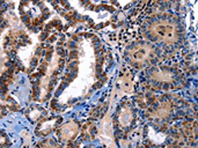 STAT5A Antibody