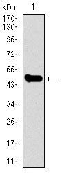 STAT5A