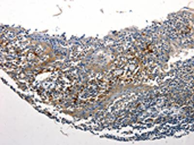 STAT5B Antibody