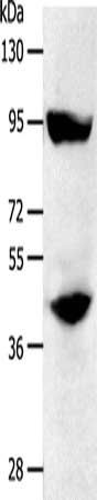 STAT5B Antibody