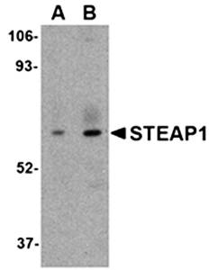 STEAP1 Antibody