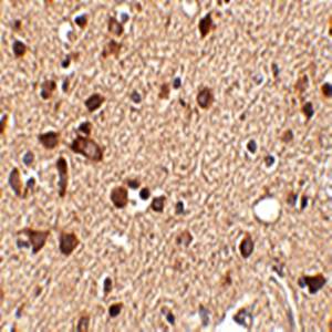 Stk39 Antibody