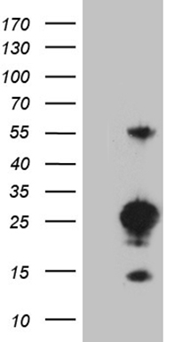 Sumo 1 Antibody