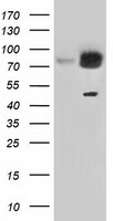 Superoxide Dismutase 1 Antibody
