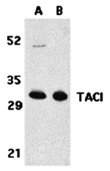 TACI Antibody