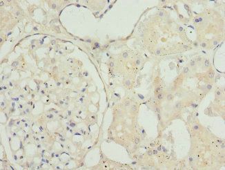 TAGLN2 Antibody