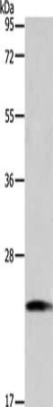 TAGLN2 Antibody