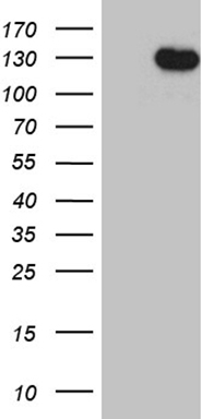 TAK1 Antibody