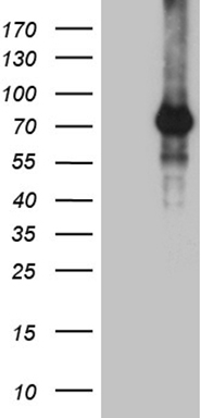 TAK1 Antibody