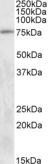 TAK1/MAP3K7 Antibody