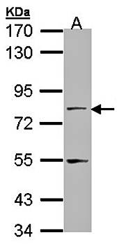 TAP antibody