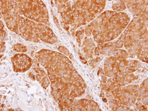 TCP1 beta antibody [C1C3]