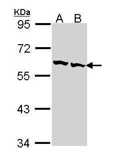 TCP1 beta antibody [C1C3]