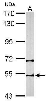 TCP1 beta antibody [C1C3]