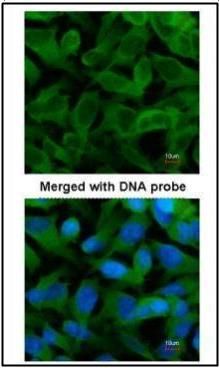 TCP1 epsilon antibody [N1N3]