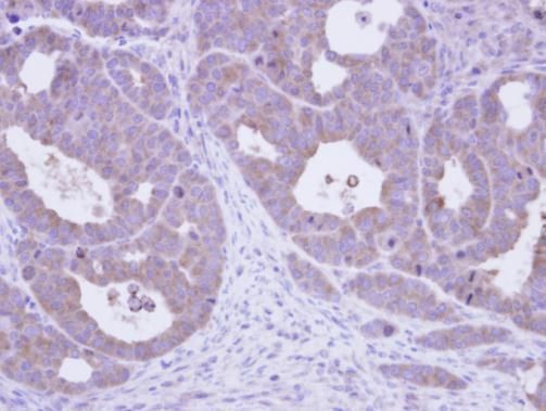 TCP1 epsilon antibody [N1N3]