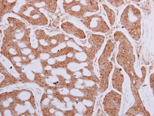 TCP1 epsilon antibody [N1C1]