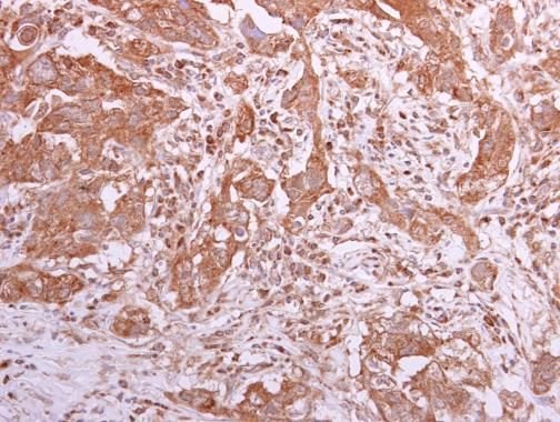 TCP1 theta antibody [N2C2], Internal