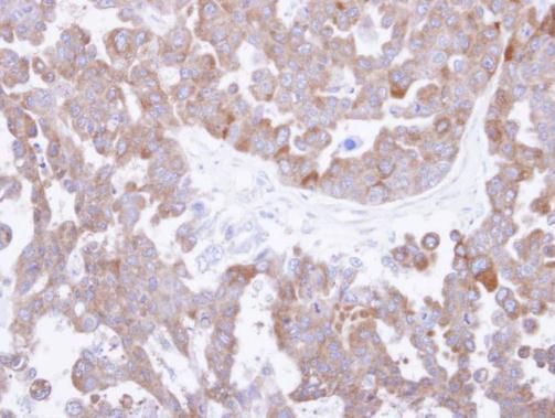 TCP1 theta antibody [N2C2], Internal