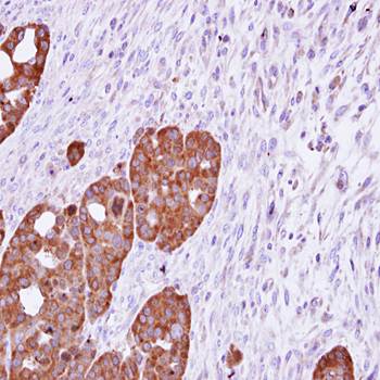 TCP epsilon antibody