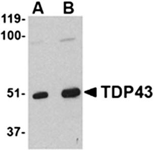 TDP43 Antibody