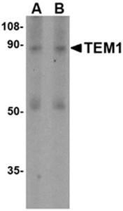 TEM1 Antibody