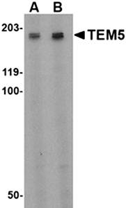 TEM5 Antibody