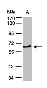 TESK2 antibody