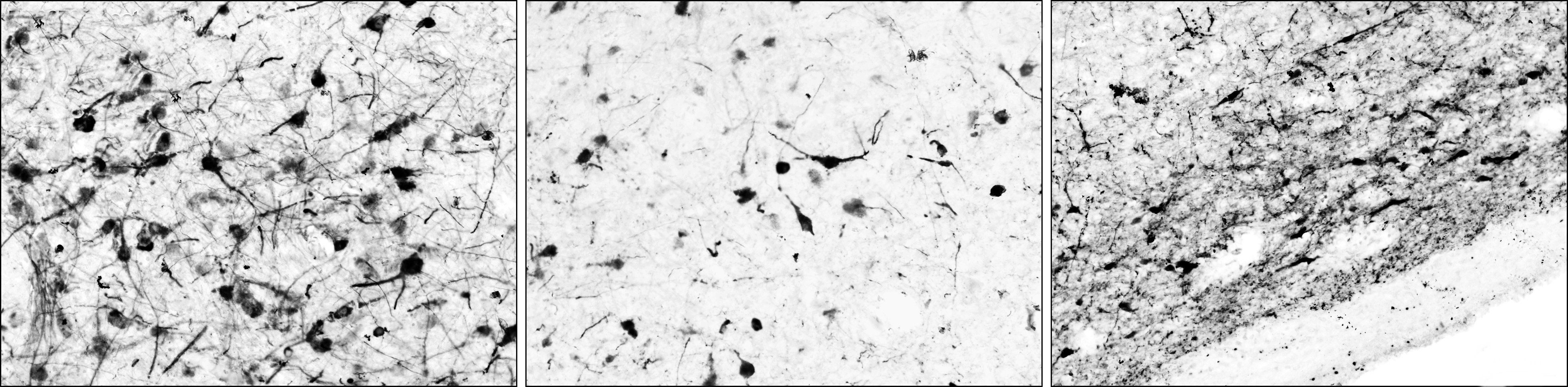 Tyrosine Hydroxylase Antibody