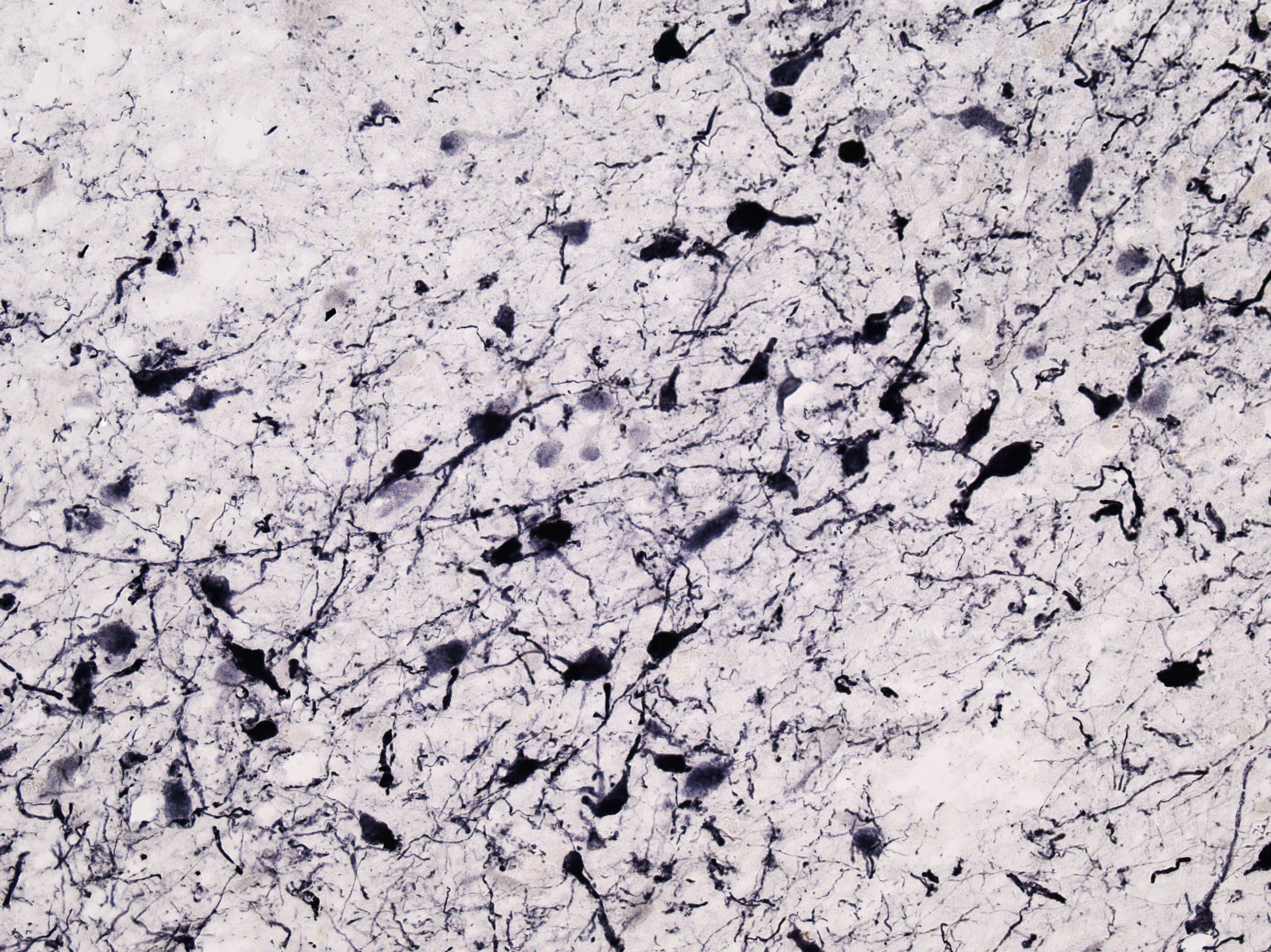 Tyrosine Hydroxylase Antibody