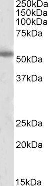 Tyrosine Hydroxylase Antibody