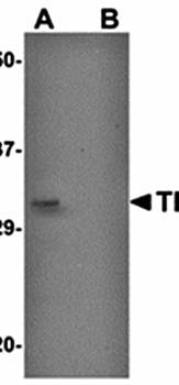 THEM2 Antibody