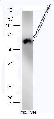 Thrombin light chain Rabbit Polyclonal Antibody