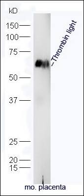 Thrombin light chain Rabbit Polyclonal Antibody