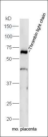 Thrombin light chain Rabbit Polyclonal Antibody