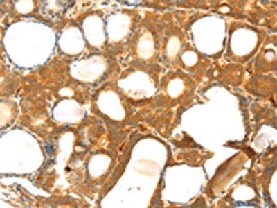 TM7SF2 Antibody