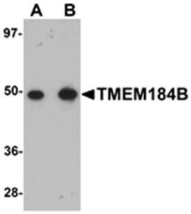 TMEM184B Antibody