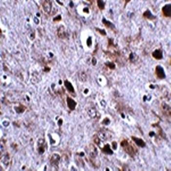TMEM18 Antibody