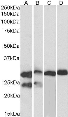 TNNI3 (aa117-127) Antibody