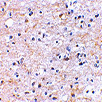 TOCA Antibody