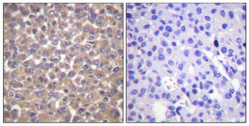 TRADD Antibody