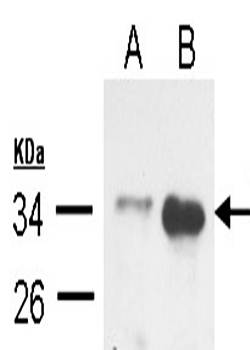 TRADD antibody